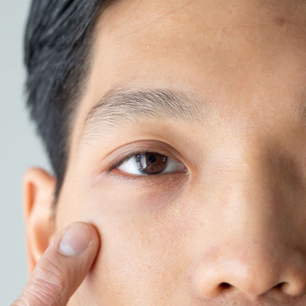 an asian man with dark circles awaiting a treatment.