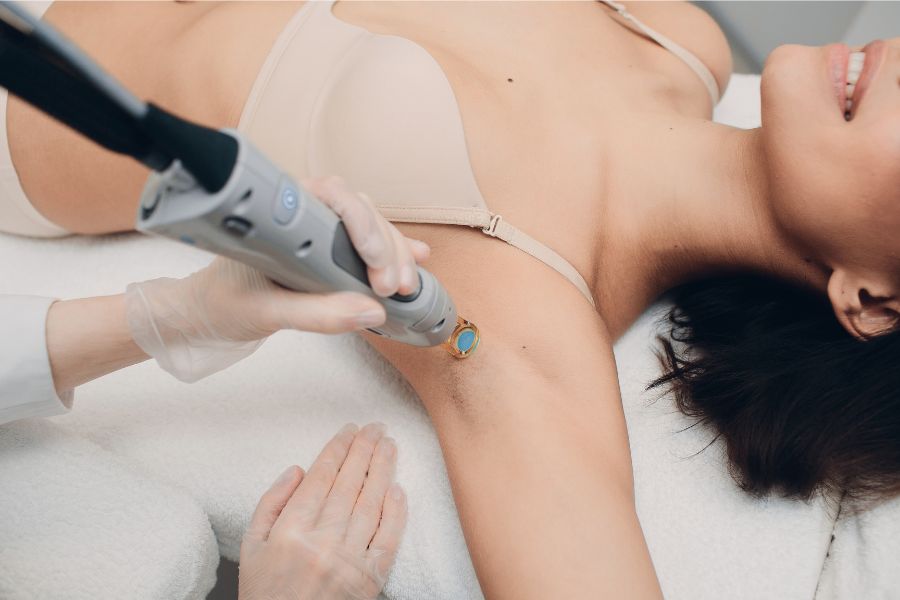 Laser hair removal at Sf Aesthetics Davnentry.